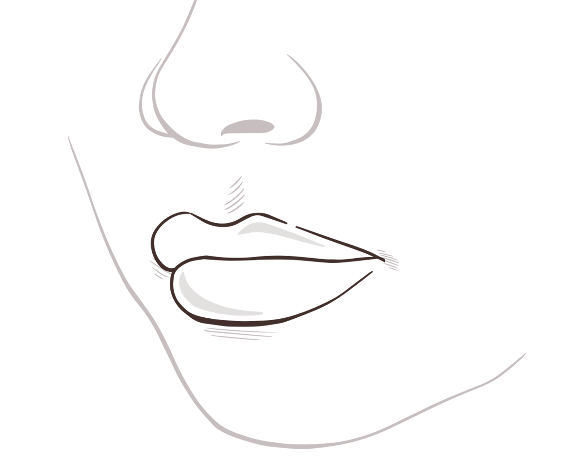 Lippe nachher