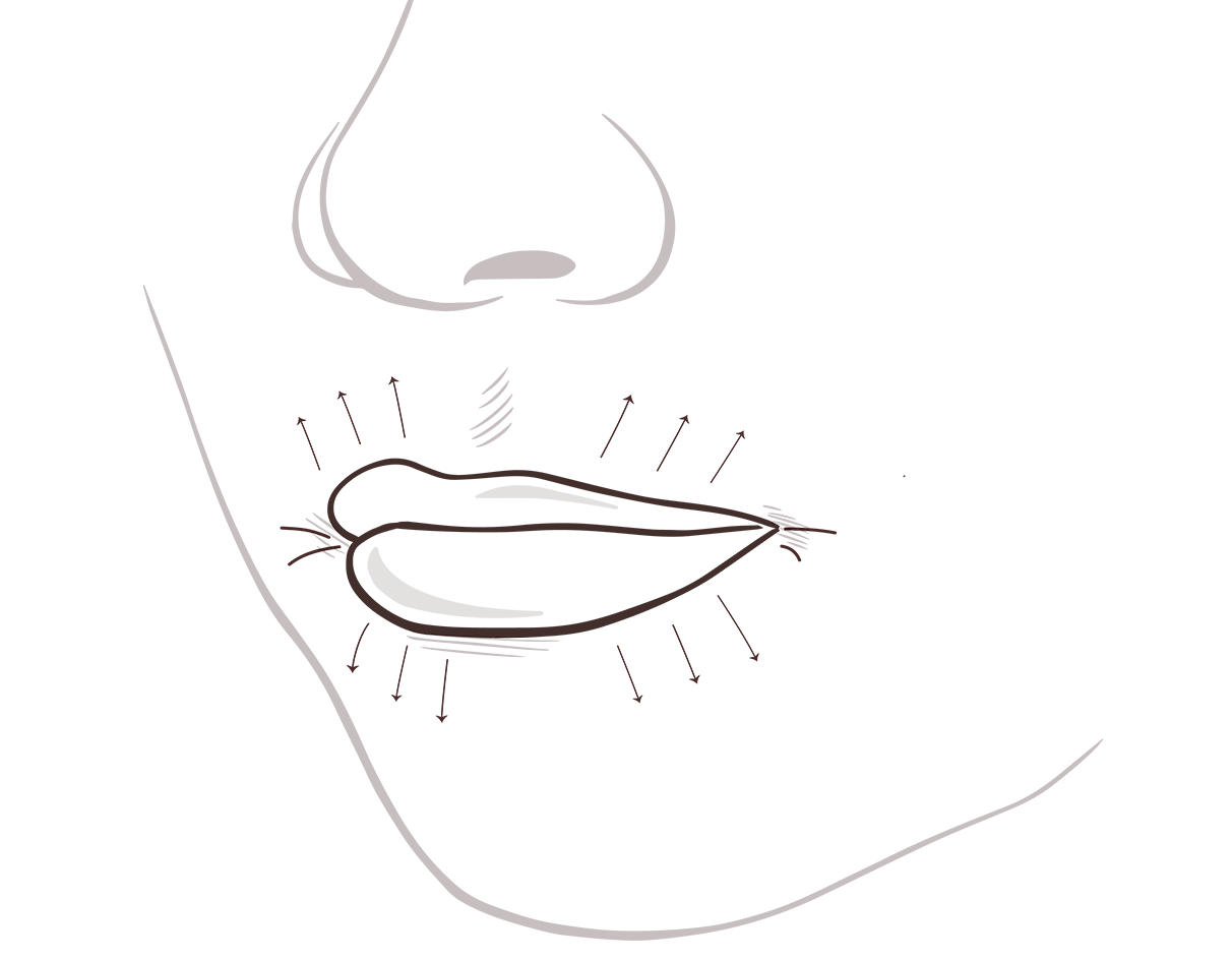 Lippe vorher
